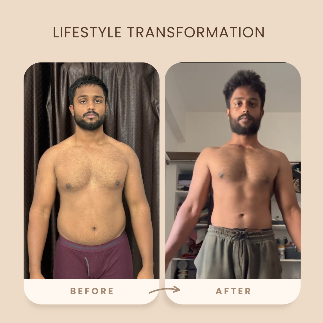 Transformation 32