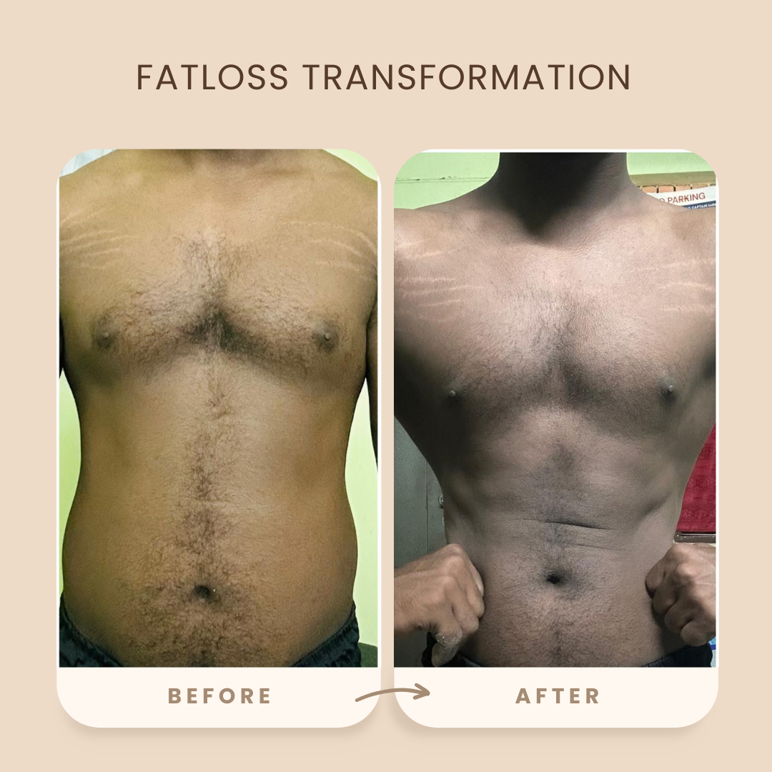 Transformation 42