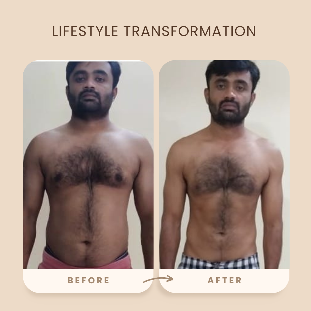 Transformation 64